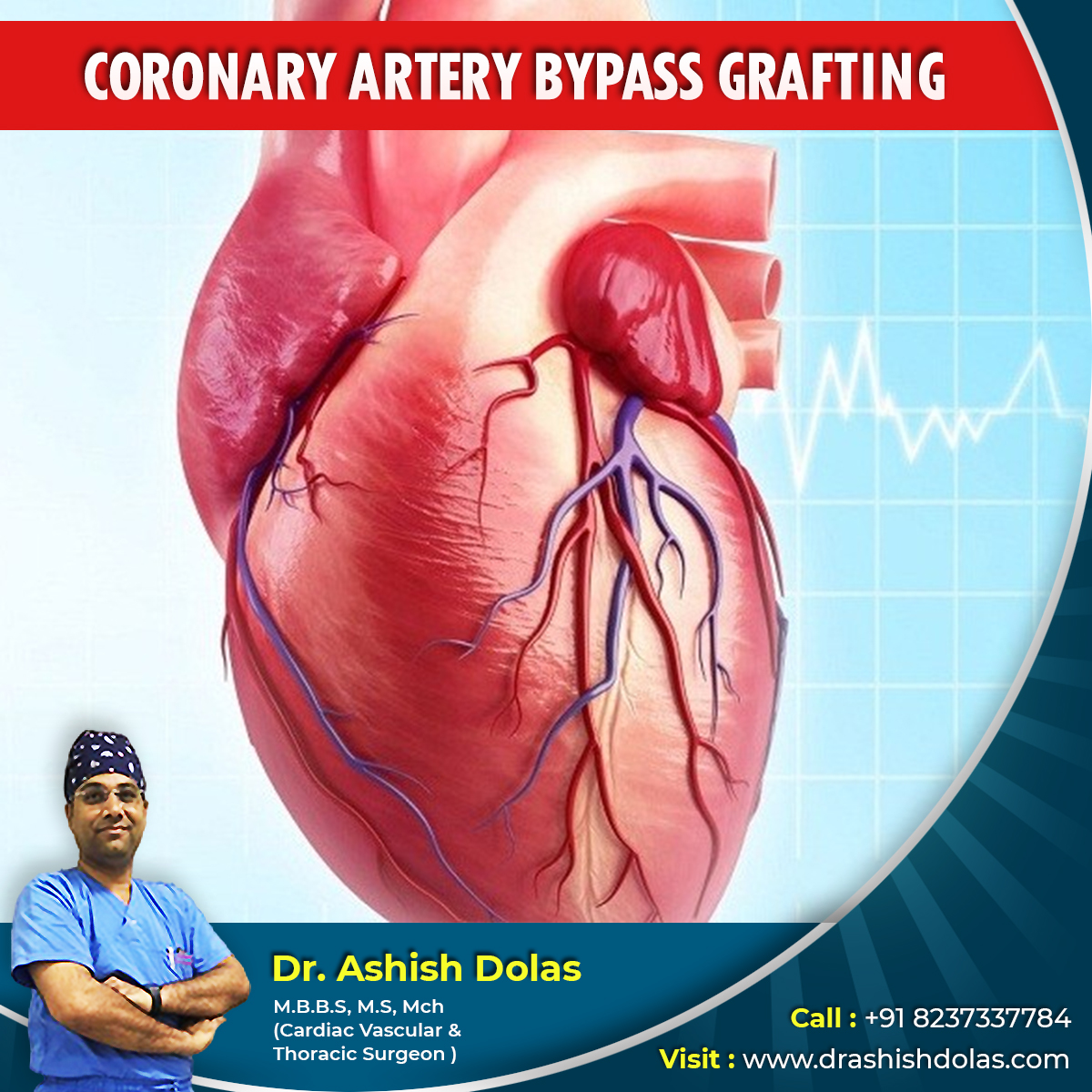 Coronary Artery Bypass Grafting_Dr. Ashish Dolas