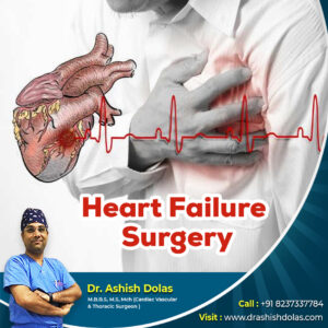 Heart Failure Surgery