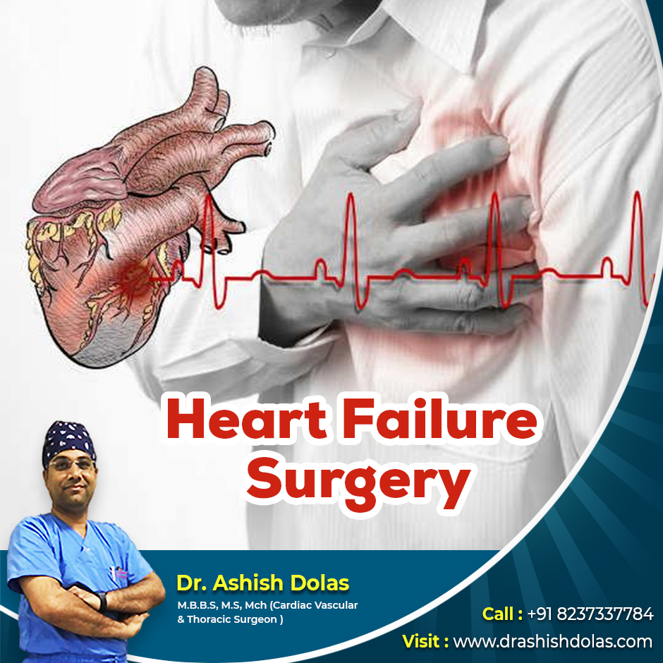 Heart Failure Surgery_Dr. Ashish Dolas