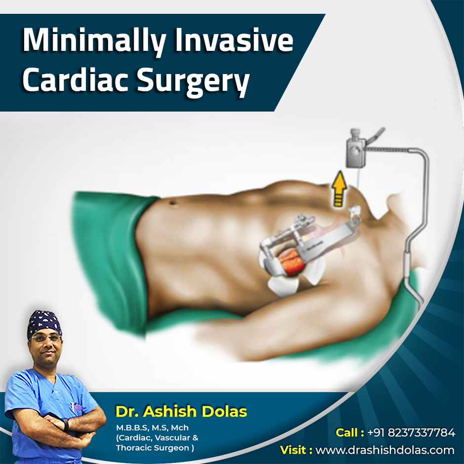 Minimally Invasive Cardiac Surgery_Dr. Ashish Dolas