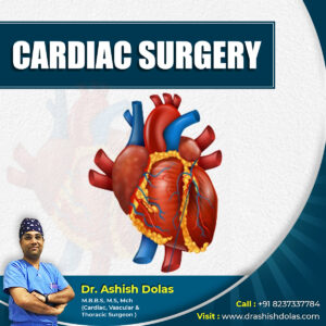 Best Cardiac Surgery in Pune - Dr. Ashish Dolas